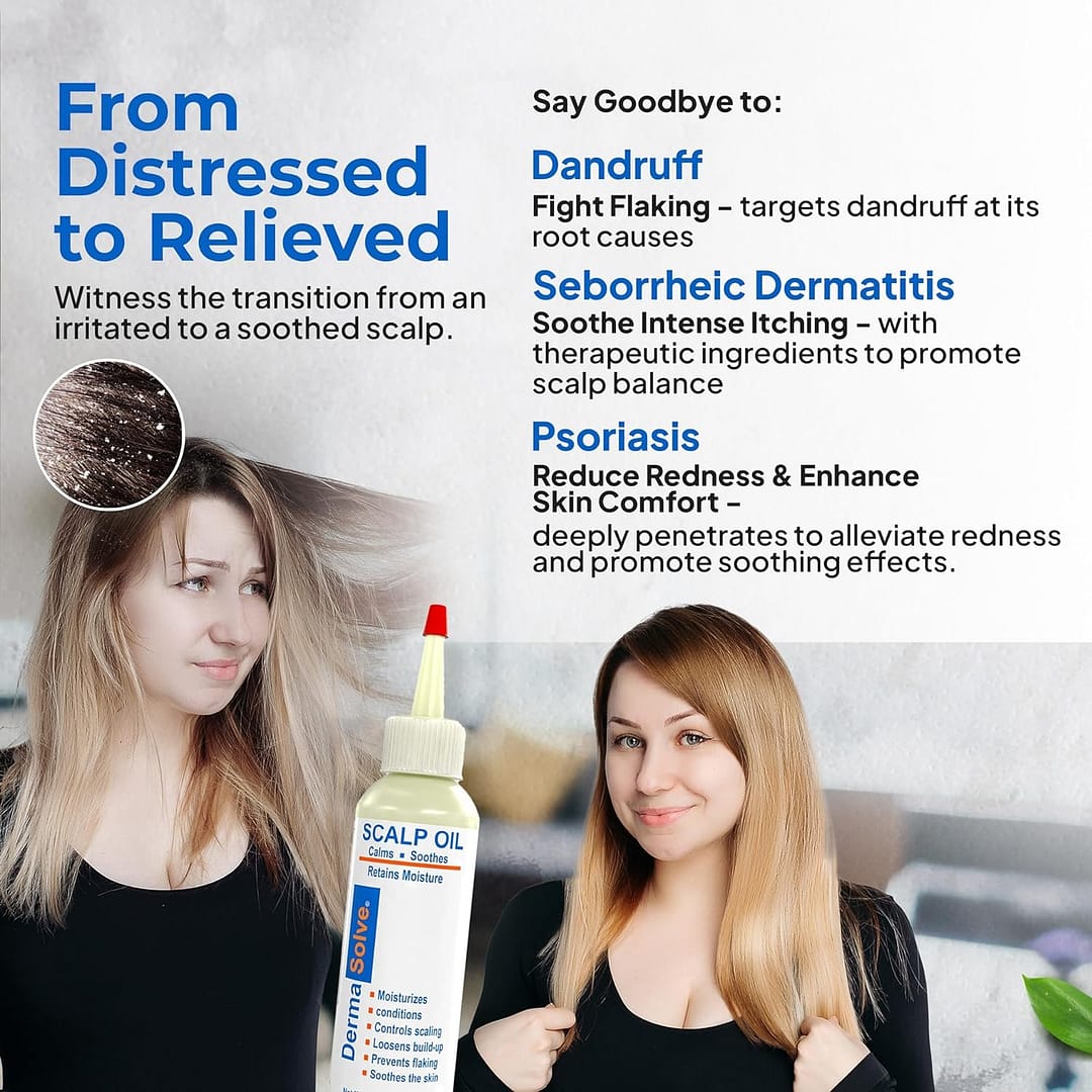 Dermasolve Scalp Oil Review