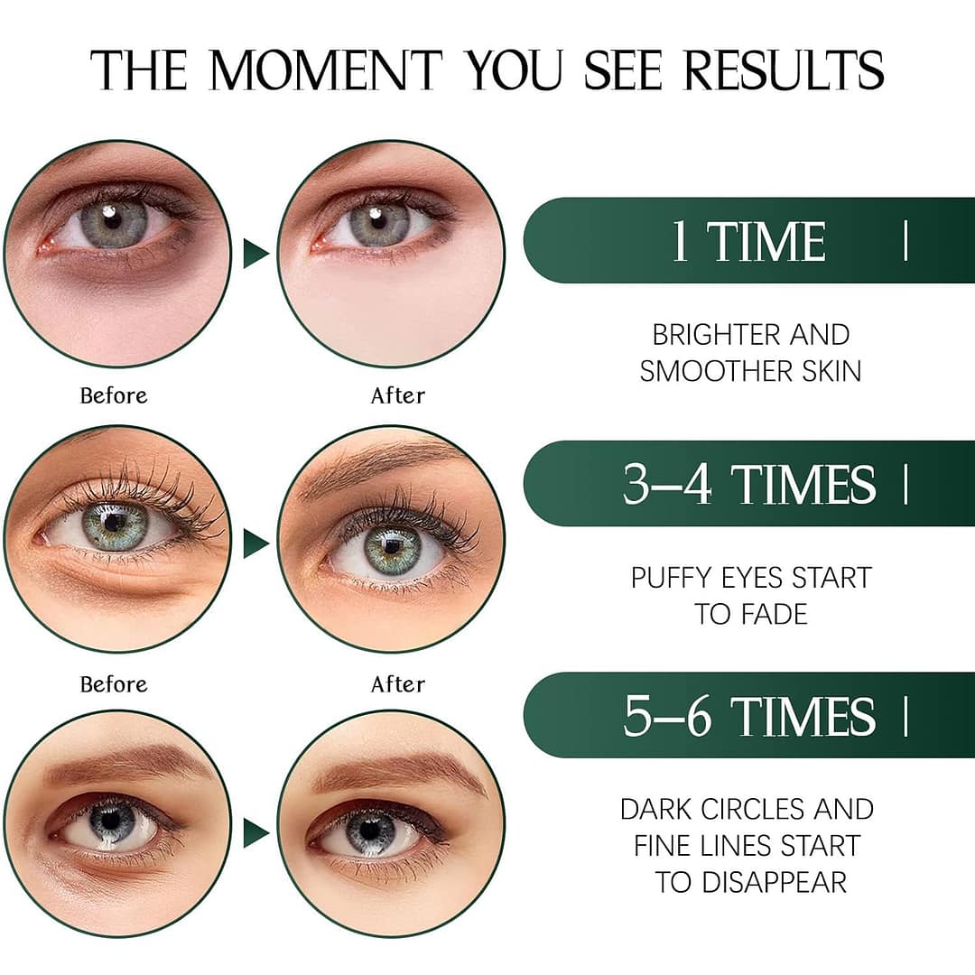 Tiepetly Under Eye Masks Review